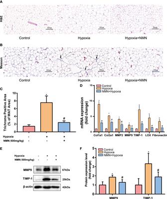 Nicotinamide mononucleotide attenuates HIF-1α activation and fibrosis in hypoxic adipose tissue via NAD+/SIRT1 axis